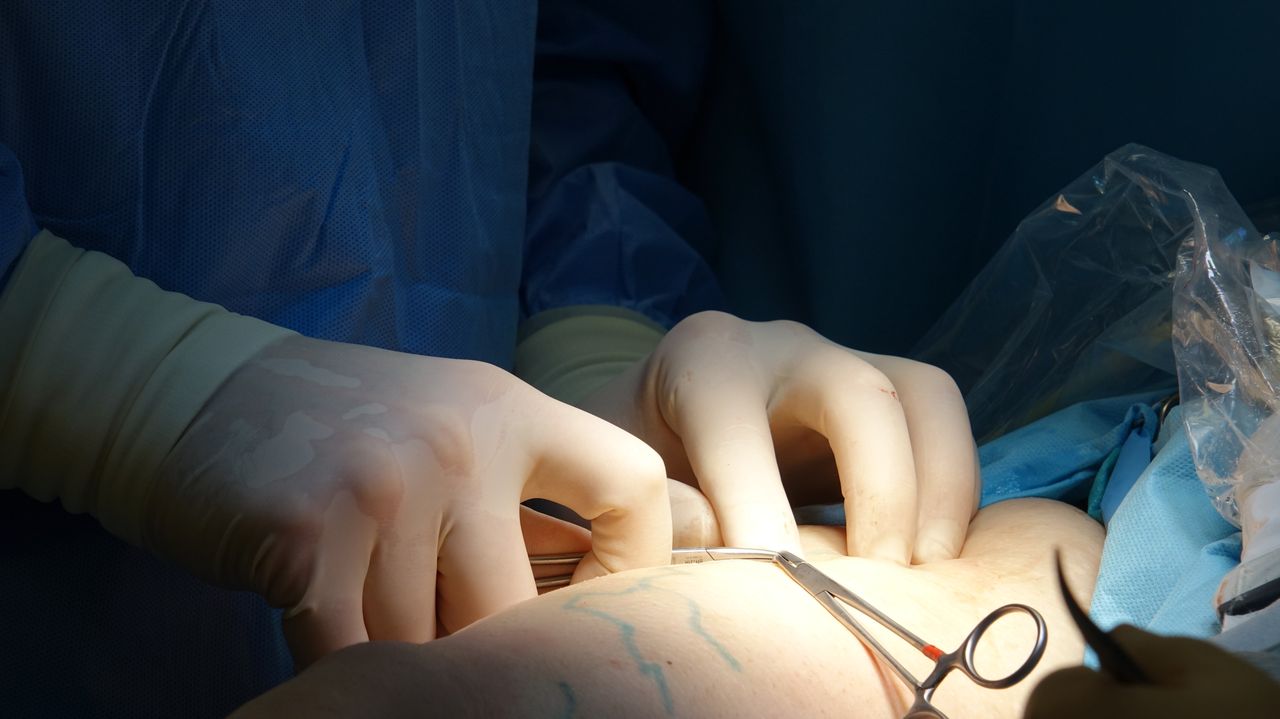 Detailed image of a surgeon's hands during a medical procedure in an operating room.